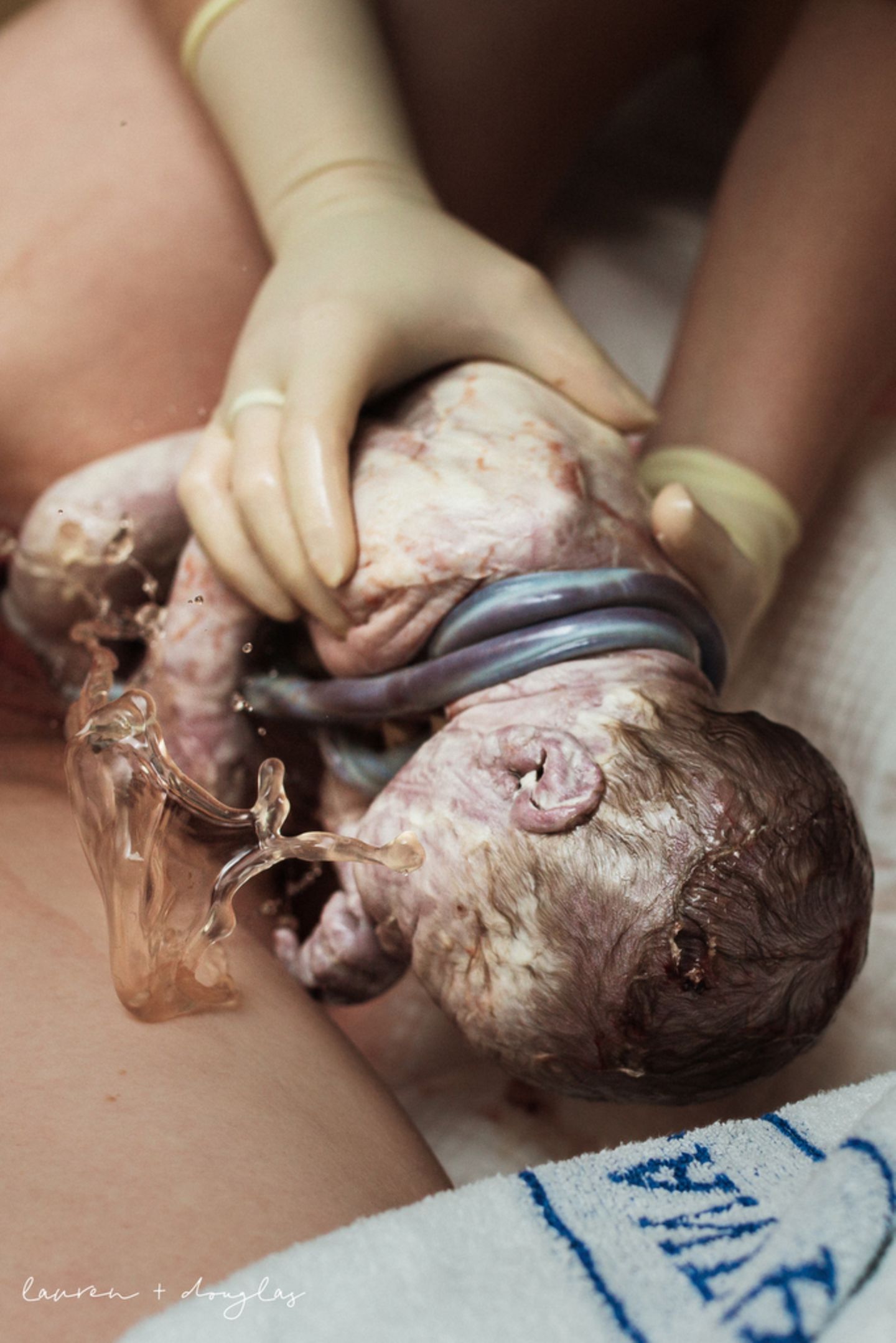 Geburtsfotos 2020: Neugeborenes mit Nabelschnur