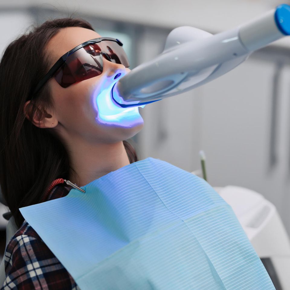 Zähne aufhellen: Bleeching beim Zahnarzt