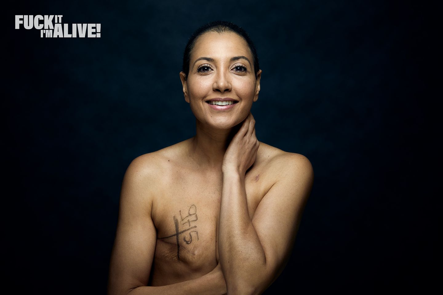 Fotoprojekt Brustkrebs: Frau posiert mit Brustkrebsnarbe