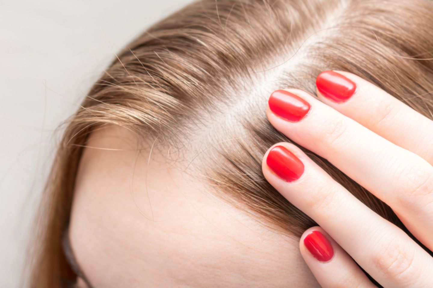 Diffuser Haarausfall: Frau fasst an ihren Scheitel