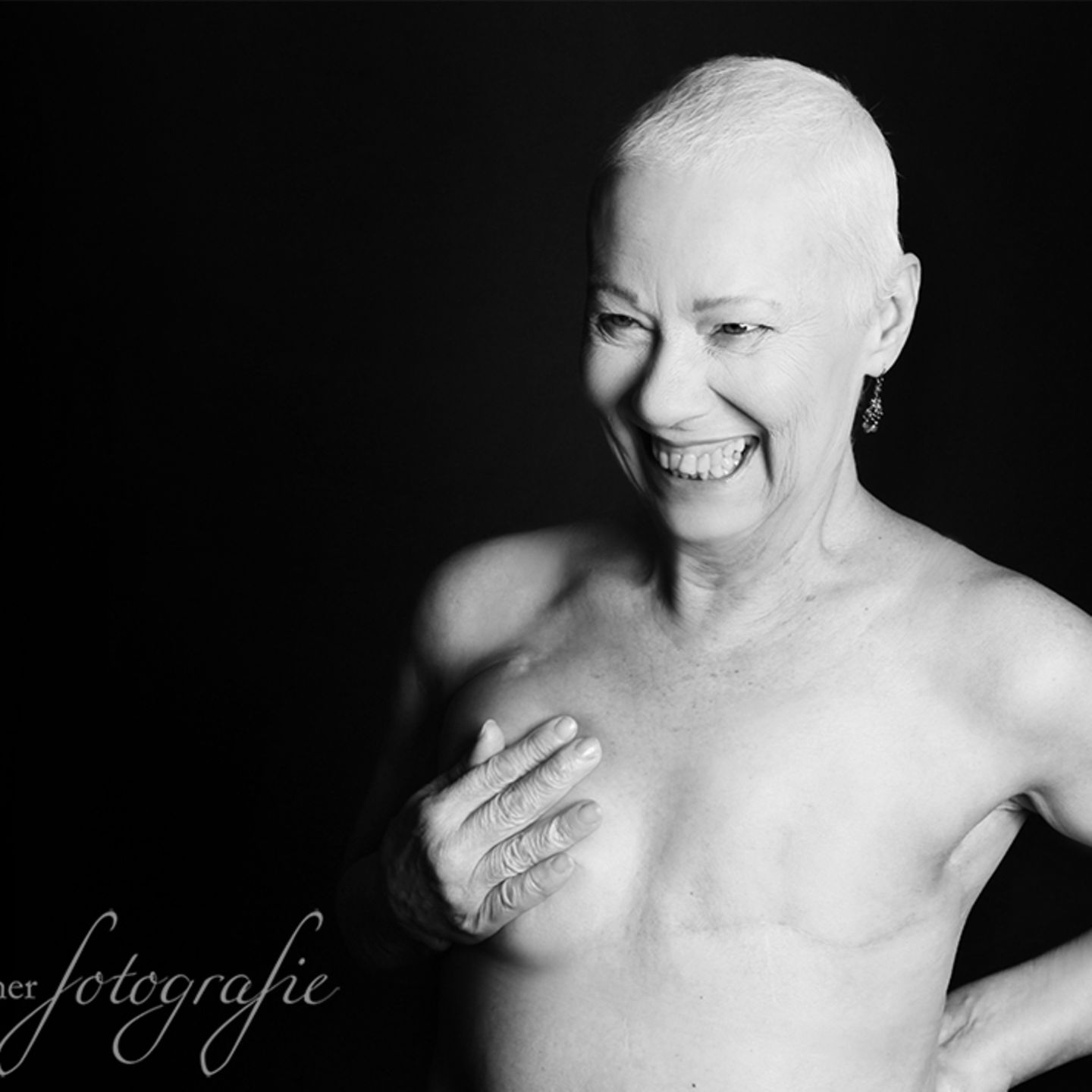 Fotoprojekt: Diese Frauen sind schön und stark. Und sie haben Krebs.