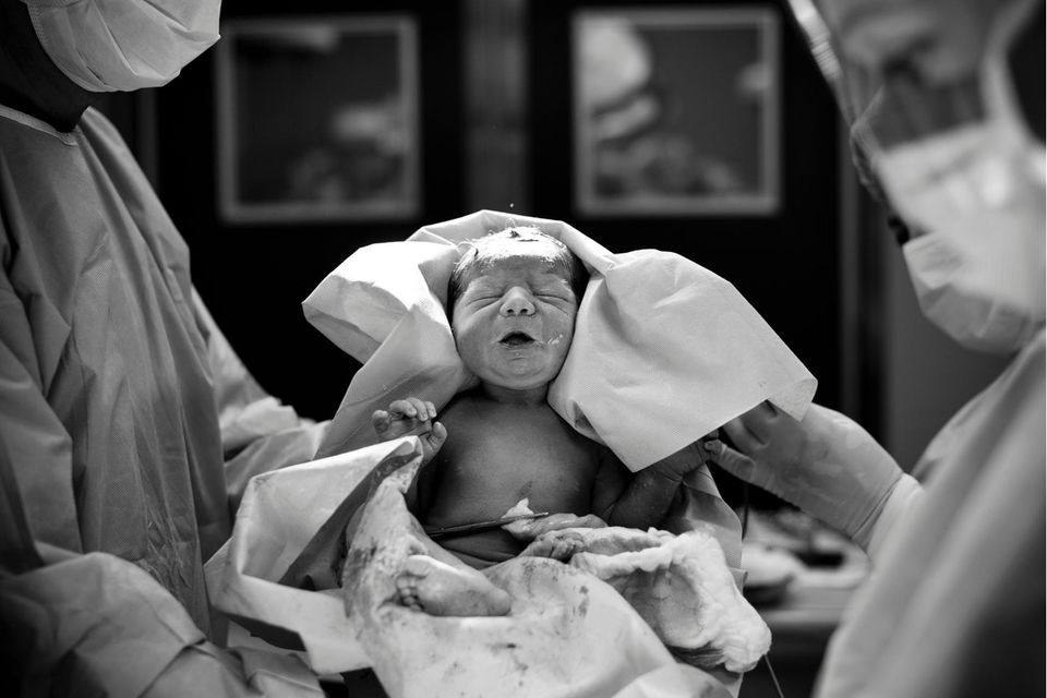 Pränataldianostik: Baby wird geboren