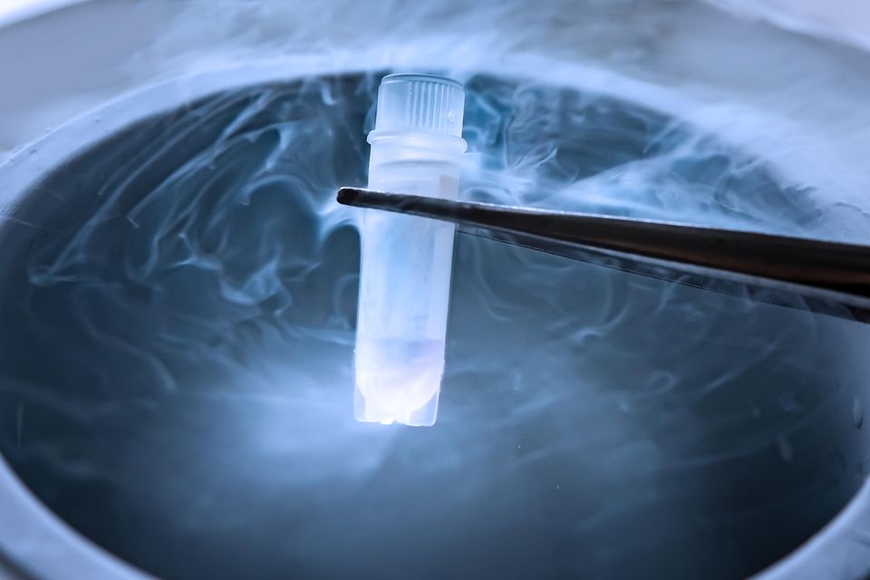 Eizellen- und Spermienproben werden zur Konservierung eingefroren. Für welche reproduktionsmedizinischen Verfahren dürfen sie in Zukunft verwendet werden?