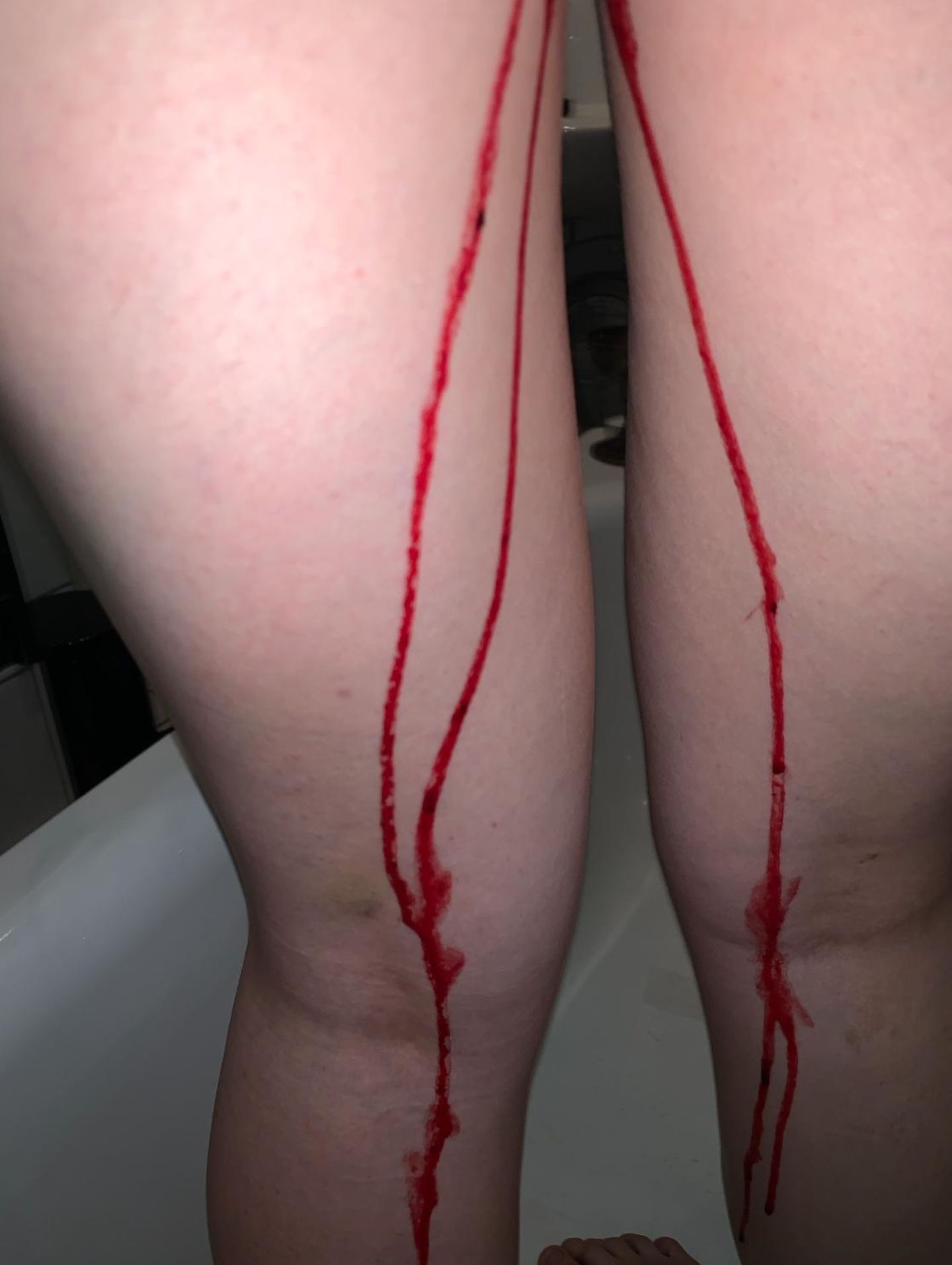How we bleed: Beine mit Blut