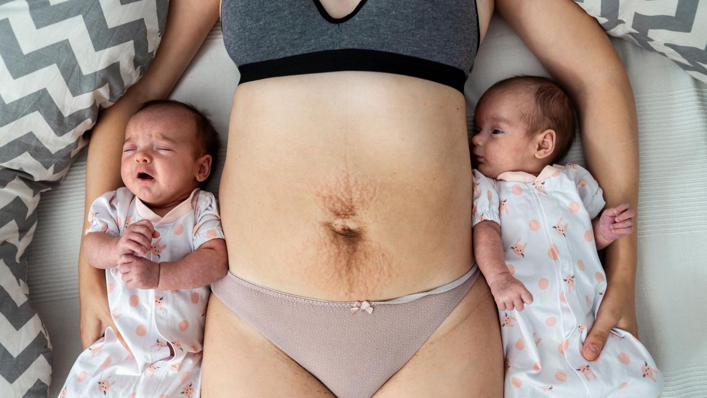 Postpartum Unfiltered: Frau liegt mit zwei Babys auf Bett