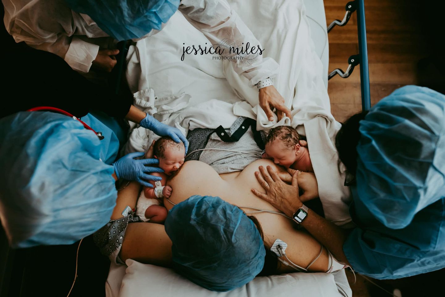 Geburtsfotografie 2022: Jessica Miles "Twins First Latch"