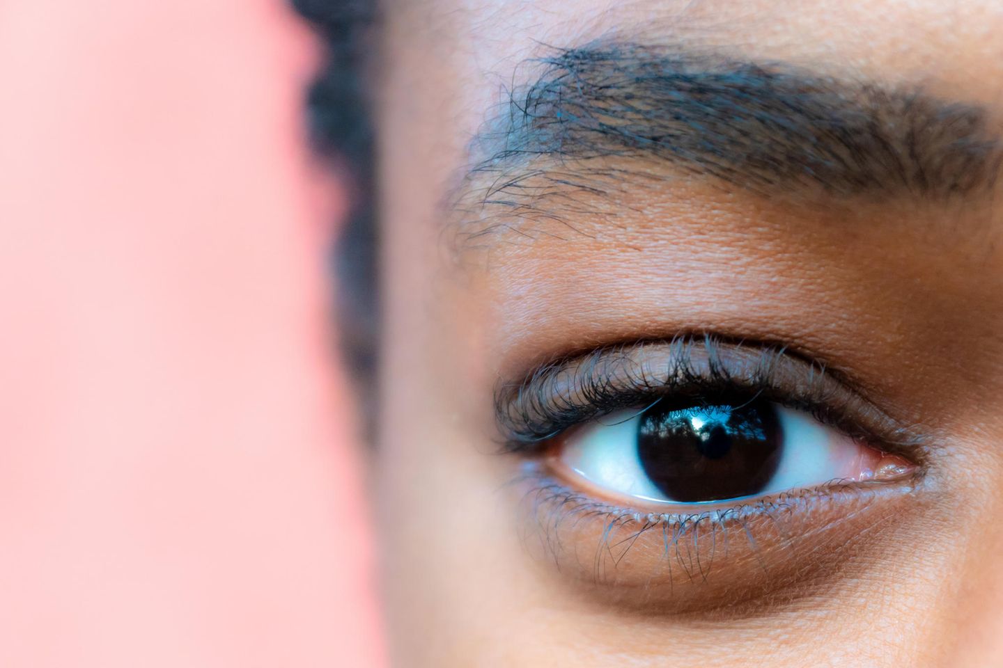 Trockene Augenlider: Ursachen und Pflegetipps für gereizte Augenpartien