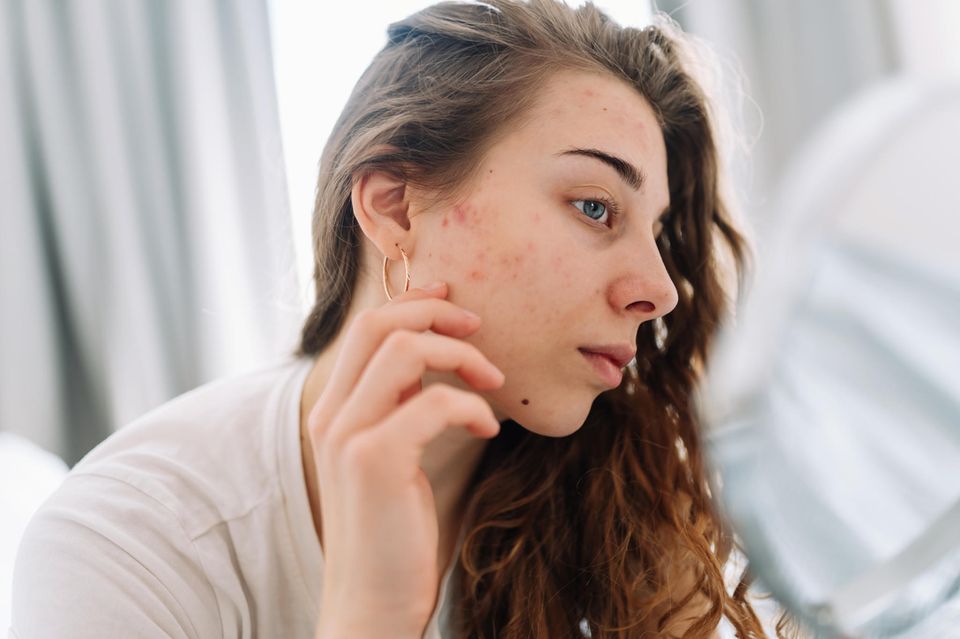 Rote Flecken im Gesicht: Frau prüft Rötungen im Gesicht