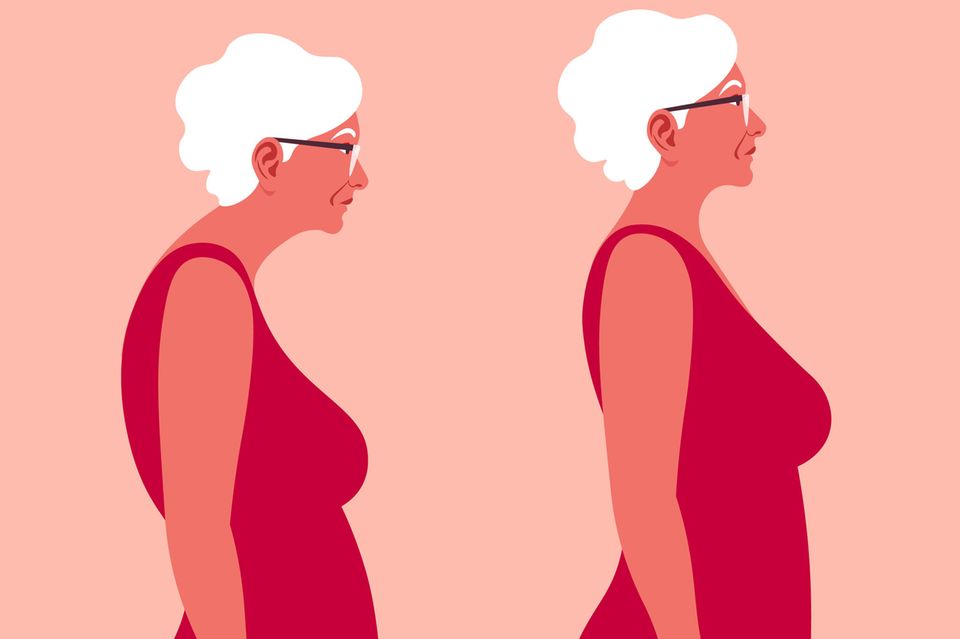 Wechseljahre und Rückenschmerzen: Illustration von einer Frau mit Witwenbuckel und ohne in der Seitenansicht