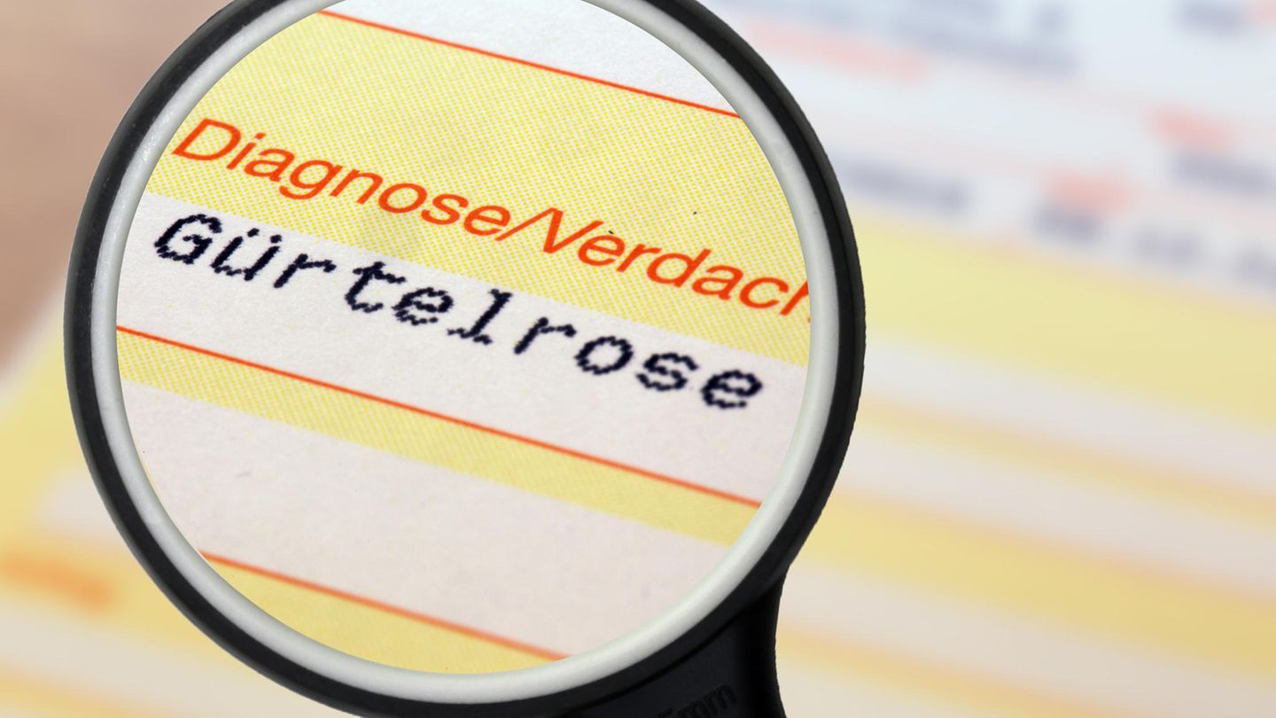 G-rtelrose-Wissen-Die-5-h-ufigsten-Irrt-mer-ber-Herpes-zoster
