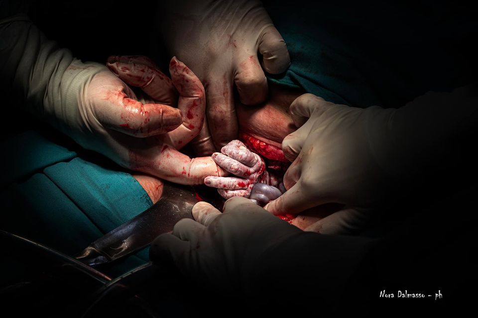 Geburtsfotografie 2024: Hände halten Neugeborenen Hand während Geburt