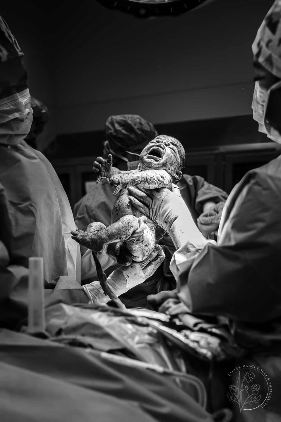 Geburtsfotografie 2024: Neugeborenes Baby wird vom Ärzteteam gehalten