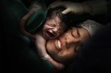 Geburtsfotografie 2024: Mutter mit schreiendem Neugeborenem