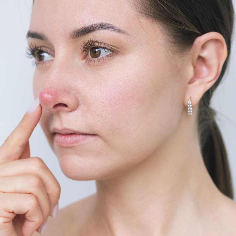 Rote Nase: Eine Frau fasst sich mit dem Zeigefinger an die rote Nasenspitze