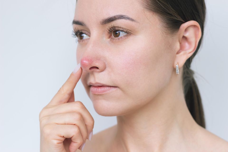 Rote Nase: Eine Frau fasst sich mit dem Zeigefinger an die rote Nasenspitze
