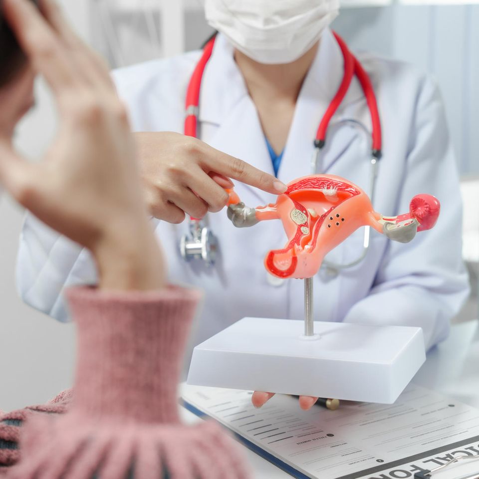 Sterilisation als Frau: Frau bei Ärztin mit Modell einer Gebärmutter