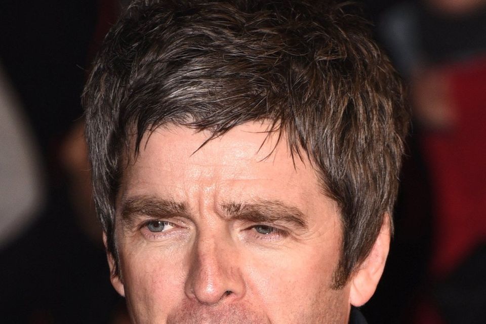 Noel Gallagher soll unter Knieproblemen leiden.