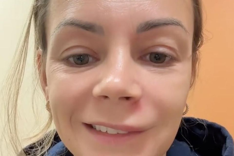 Una donna con il viso gonfio guarda nella telecamera