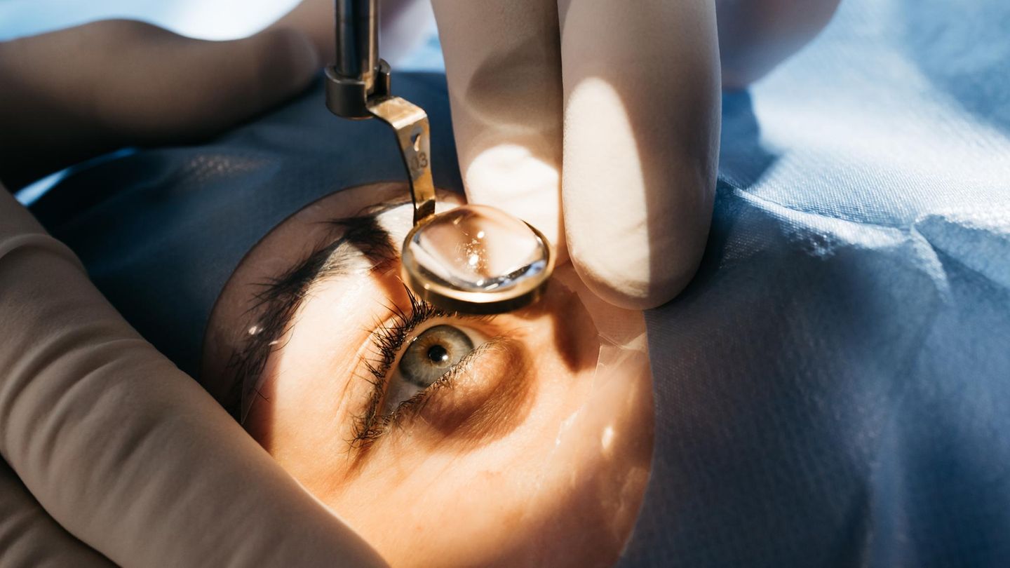 Lasern-oder-Linsentausch-Alternativen-zur-Brille-und-wann-diese-Sinn-machen