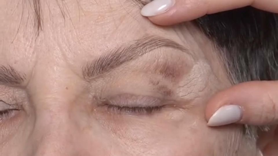 Консилер здесь нанесен слишком близко к центру, но идеально начинается во внешнем уголке глаза, проходя над боковой частью нависшего века.