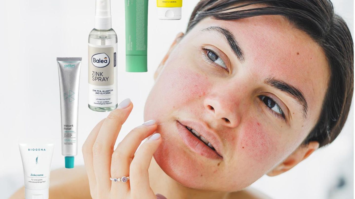 R-tungen-und-Unreinheiten-12-effektive-Produkte-mit-Zink-gegen-R-tungen